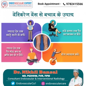Get varicose veins treatment in Jaipur by Dr. Nikhil Bansal